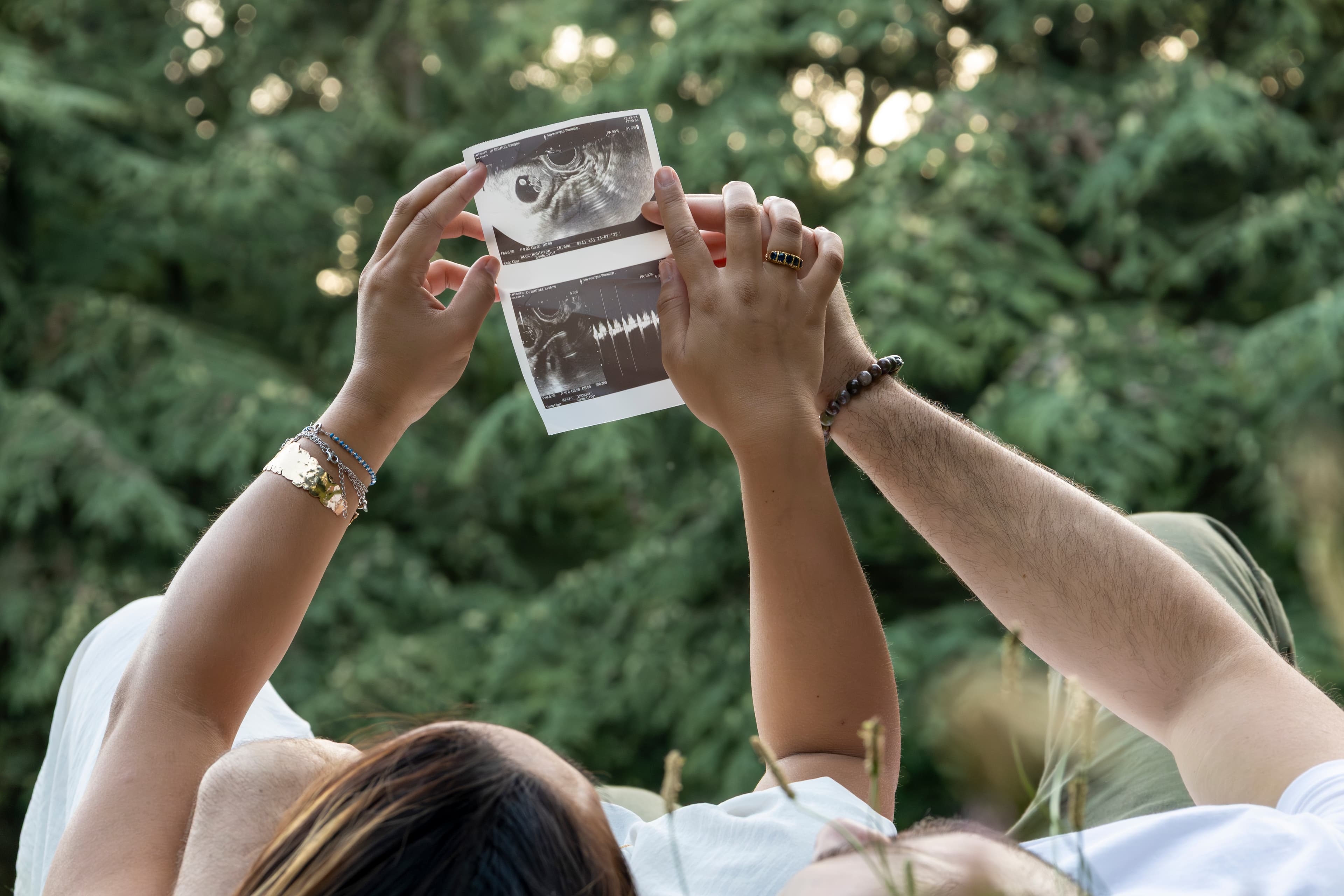 Photo Echographie Grossesse